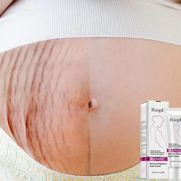 STRETCH MARK CREAM